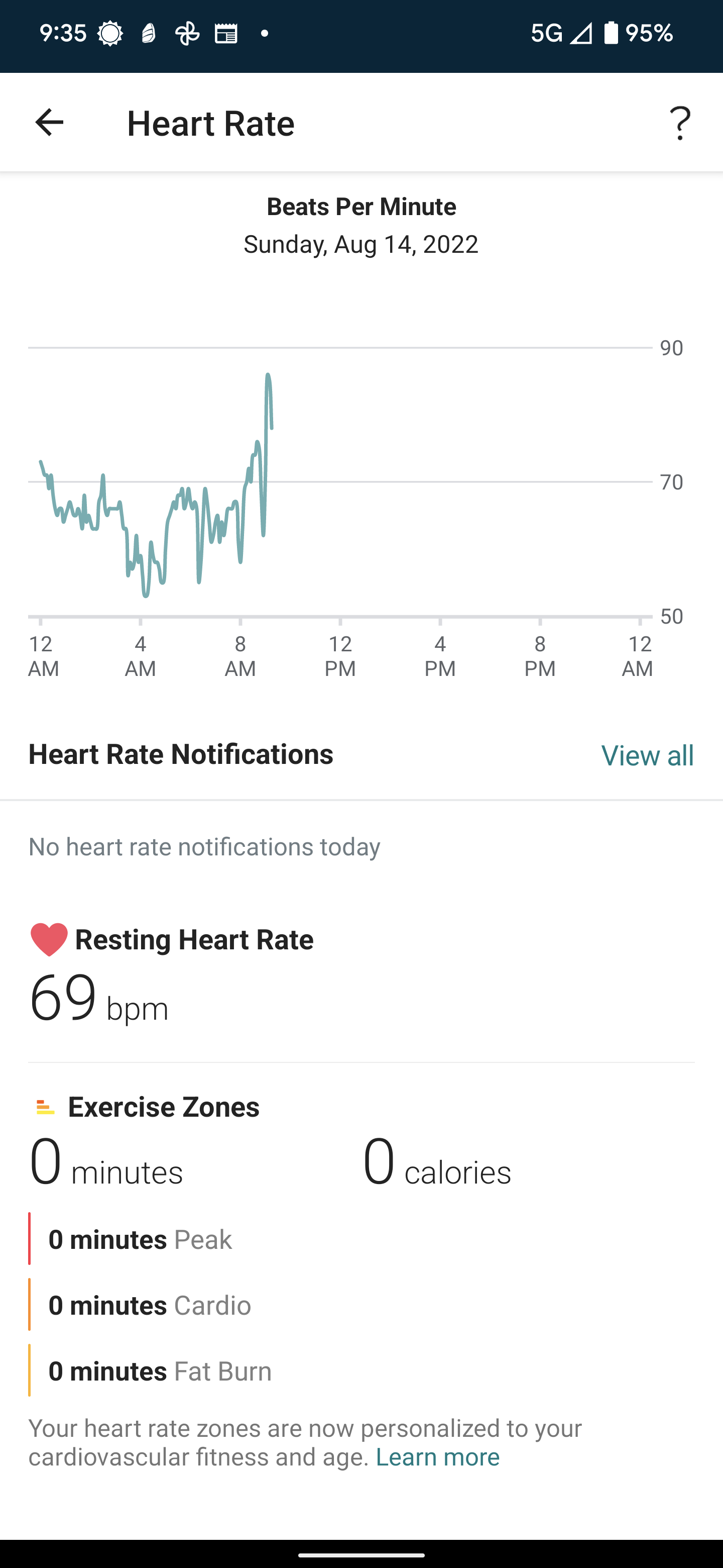 Bradycardia while sleeping